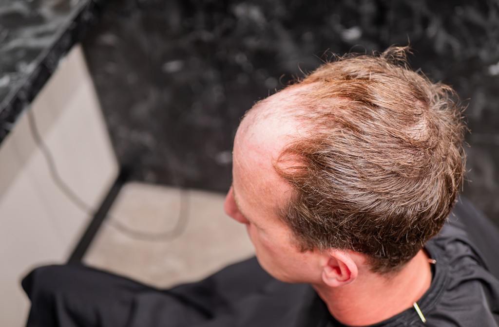 haarwerken-heren-voor.jpg haarwerken-heren-voor.jpg